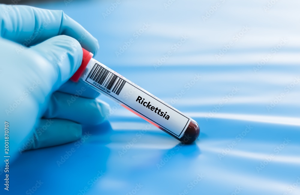 Obraz premium Blood sample tube for rickettsia test analysis.