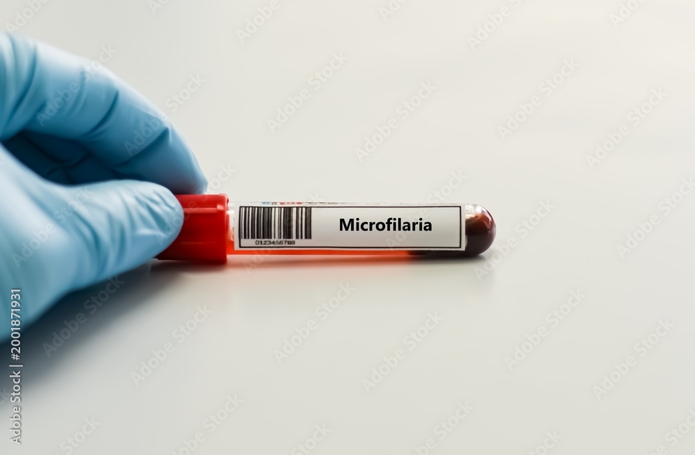 Obraz premium Blood sample tube for microfilaria test analysis.