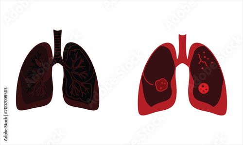 Human lungs anatomy illustration a detailed view of respiratory system organs