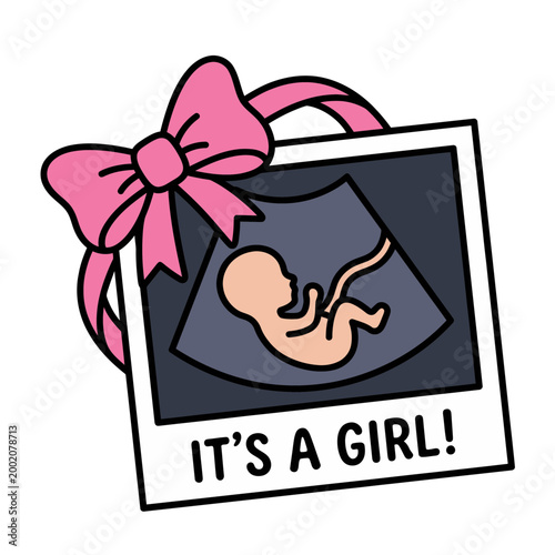 Gender reveal ultrasound scan with question mark, pregnancy mystery and baby announcement flat vector illustration