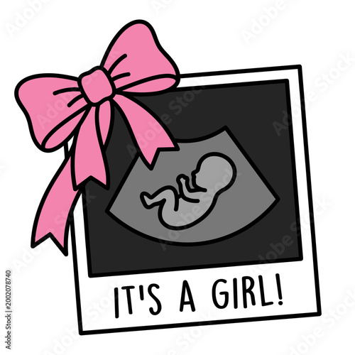 Gender reveal ultrasound scan with question mark, pregnancy mystery and baby announcement flat vector illustration