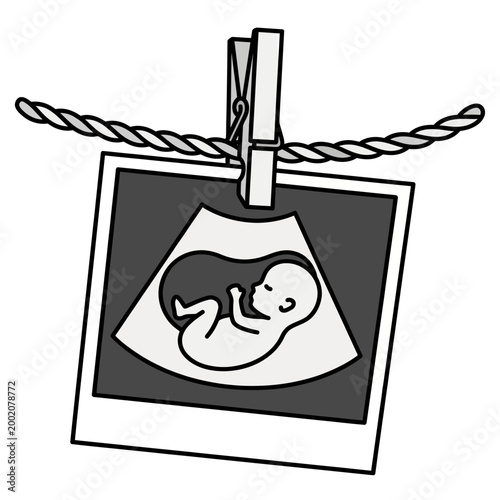 Baby ultrasound photo hanging on a decorative string, prenatal announcement and pregnancy journey concept flat vector illustration