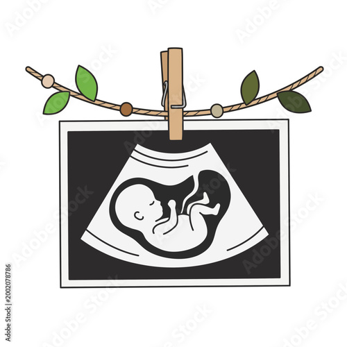 Baby ultrasound photo hanging on a decorative string, prenatal announcement and pregnancy journey concept flat vector illustration