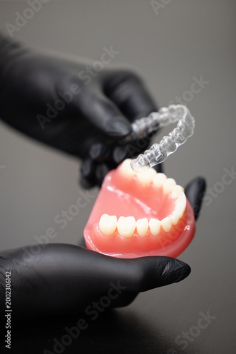 Transparent dental aligner on jaw model modern invisible orthodontic