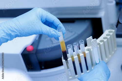 Fotografi Gloved hands of doctor handling blood sample test tubes in laboratory