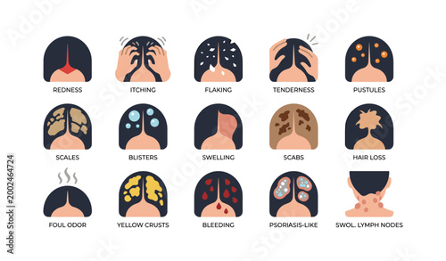 Scalp condition icons showing symptoms on head illustrations