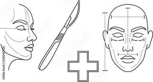 Medical illustration of plastic surgery procedure and facial marking.