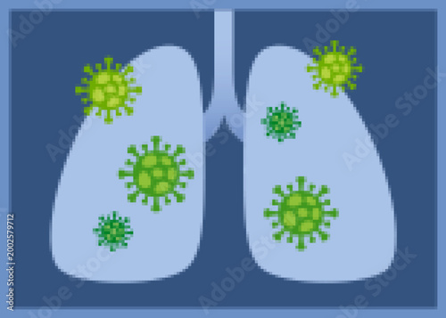Lung X-ray shows virus