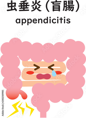 虫垂炎になった大腸　キャラ