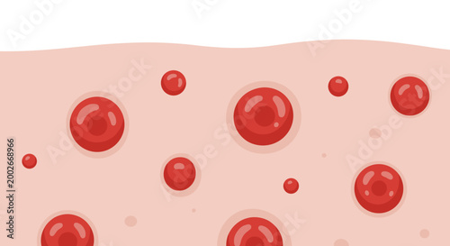 Illustration of skin with red hives showing a close-up view of dermatological condition on a smooth surface, with a minimalistic white background, (3)
