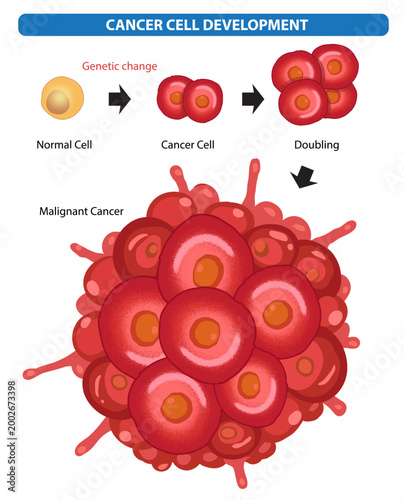 Cancer Cell Development Stages Illustration