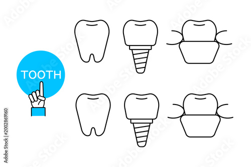インプラントや入れ歯などの様々な歯のアイコン