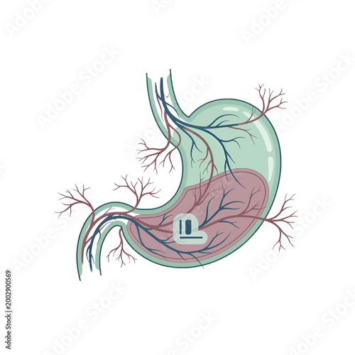 Internal organ with vascular system and a small implant