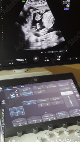 Obstetrician operating an ultrasound machine, examining a fetus on the monitor during a prenatal checkup for a pregnant woman in a modern clinic, focusing on the screen and doctor's hands