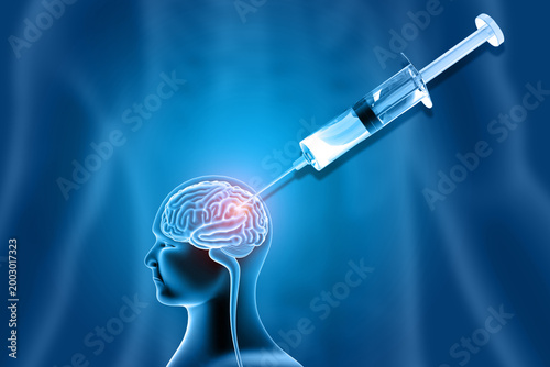Detailed 3D illustration of a medical syringe administering an injection into human brain anatomy