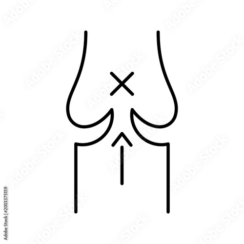 Blood vessel stenosis icon. Healthcare and cardiology line symbol. Black and white.