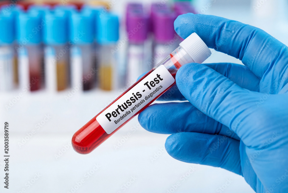 Obraz premium Doctor holding a blood sample for a pertussis test in a pediatric medical laboratory