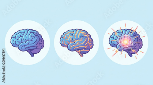 Infographic illustration of a brain with areas highlighted in orange and a burst of light on a light blue background