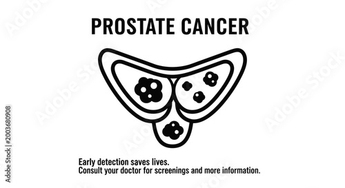 Prostate cancer awareness illustration with medical cross-section and early detection text.
