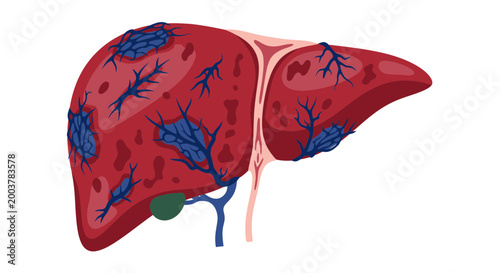 Human Liver Anatomy Illustration with Vascular Network and Gallbladder