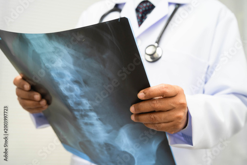 Doctor examining spine bone radiography xray film.