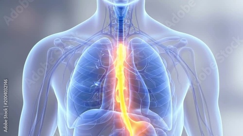 Acid reflux and gerd cause back flow of stomach acid into esophagus creating inflammation and discomfort in chest area with painful symptoms from stomach contents flow back