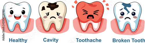Teeth decay stages illustration, dental caries progression diagram