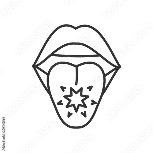 Tongue cancer linear icon. Malignant tumors and sores. Mouth and oral cancer. Abnormal cells growth. Thin line illustration. Contour symbol. Vector outline drawing. Editable stroke. Arial font used