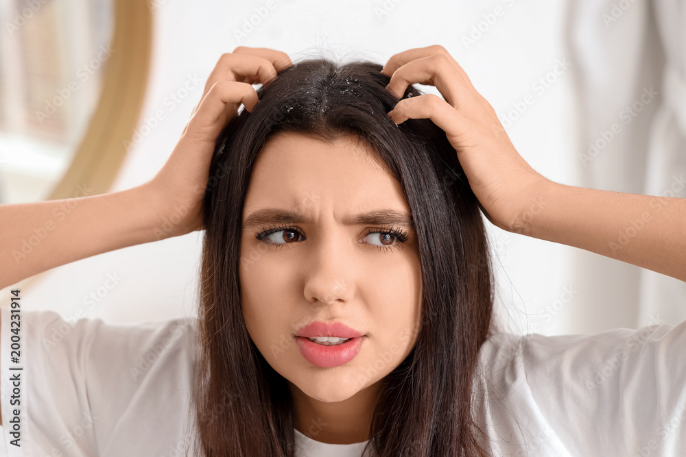 Naklejka premium Stressed young woman with dandruff problem scratching head in light bathroom