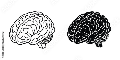 Fotografie Comparison of a healthy brain and a brain affected by neurodegenerative changes