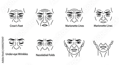 Foto Facial wrinkle diagrams line art illustrations on white background