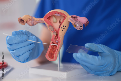 Gloved hands holding swab near uterine model, closeup of technician transferring cervical specimen onto glass slide using sterile