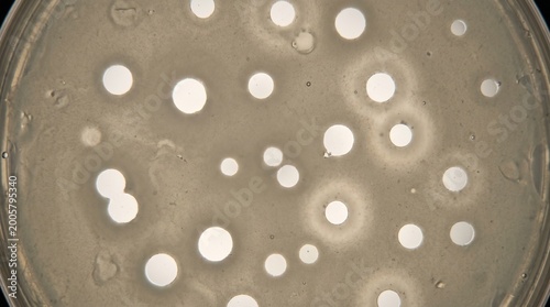 Phage Display Viral Plaque Assay Petri Dish