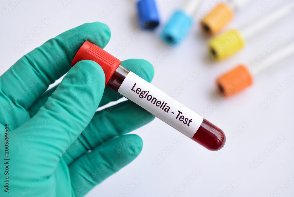 Obraz premium Laboratory technician holding a blood sample for a legionella bacteria test