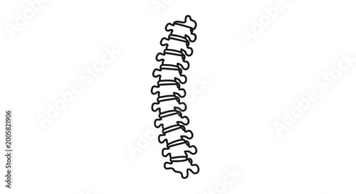 Curved Spine Illustration: Scoliosis, Backbone Deformity, Medical Concept