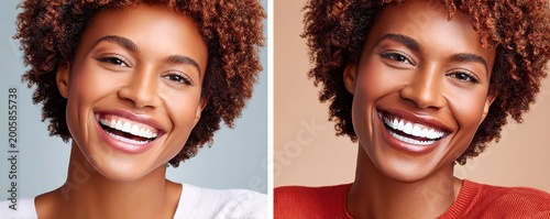 Smiling woman before and after teeth whitening showing bright white smile and confident portrait