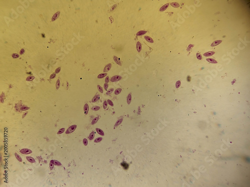 Tableau sur toile Paramecium caudatum Binary Fission Stages Showing Transverse Cell Division Pr
