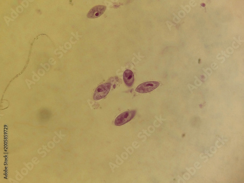 Paramecium caudatum Binary Fission Stages Showing Transverse Cell Division Pr