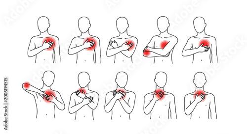 Billede på lærred Illustrative depiction of individuals experiencing varying locations of chest an