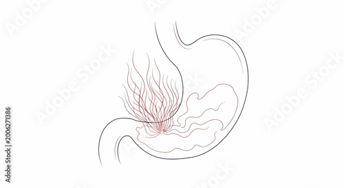 Fotografia Illustration of stomach acid burning and digestive juices