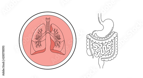 Comparative anatomy illustration of human lungs with infection spots in a circle next to the entire digestive system outline.