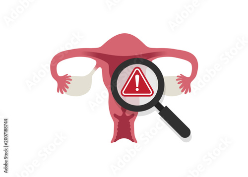 Reproductive Health Awareness and Medical Diagnosis Illustration