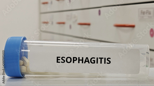 Photos ESOPHAGITIS treatment tablets for reduce inflammation of the esophagus