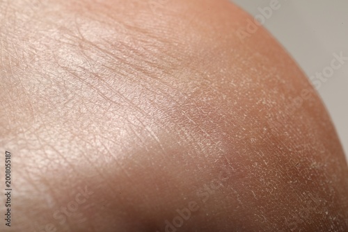 Man with dry skin on his heel against light background, closeup