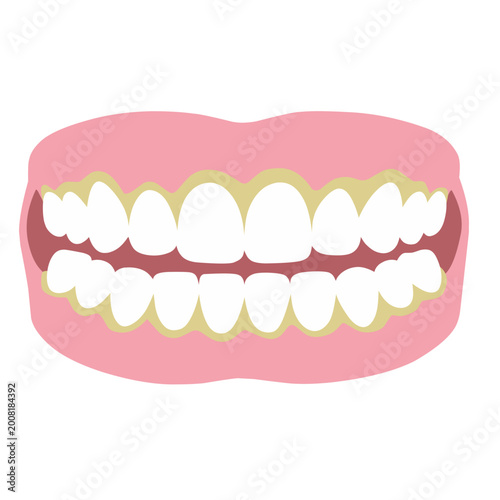 Dentures with Plaque Illustration