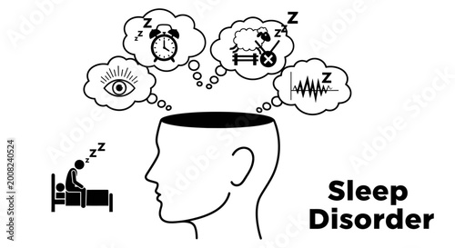 Sleep Disorder concept illustration with human head profile and insomnia symbols.