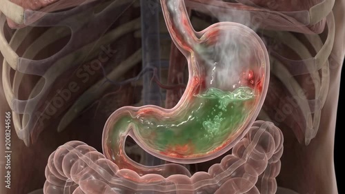3D human stomach with bubbling green acid and rising steam, heartburn and acid reflux concept, digestive inflammation visualization, 4K video