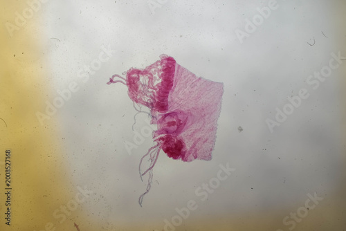 Schilderij op canvas Stained Aurelia Medusa Tentaculocyst Margin Microscope Sli