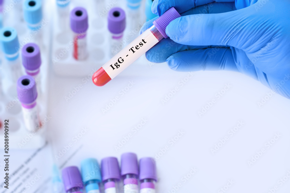 Naklejka premium Doctor holding IgE blood test tube explaining allergy diagnosis, immunoglobulin E level assessment and evaluation of hypersensitivity reactions in clinical laboratory diagnostics