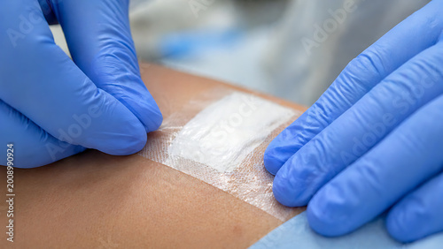 Close Up of Gloved Hands Applying Transparent Medical Dressing on Patient Skin for Wound Protection and Care